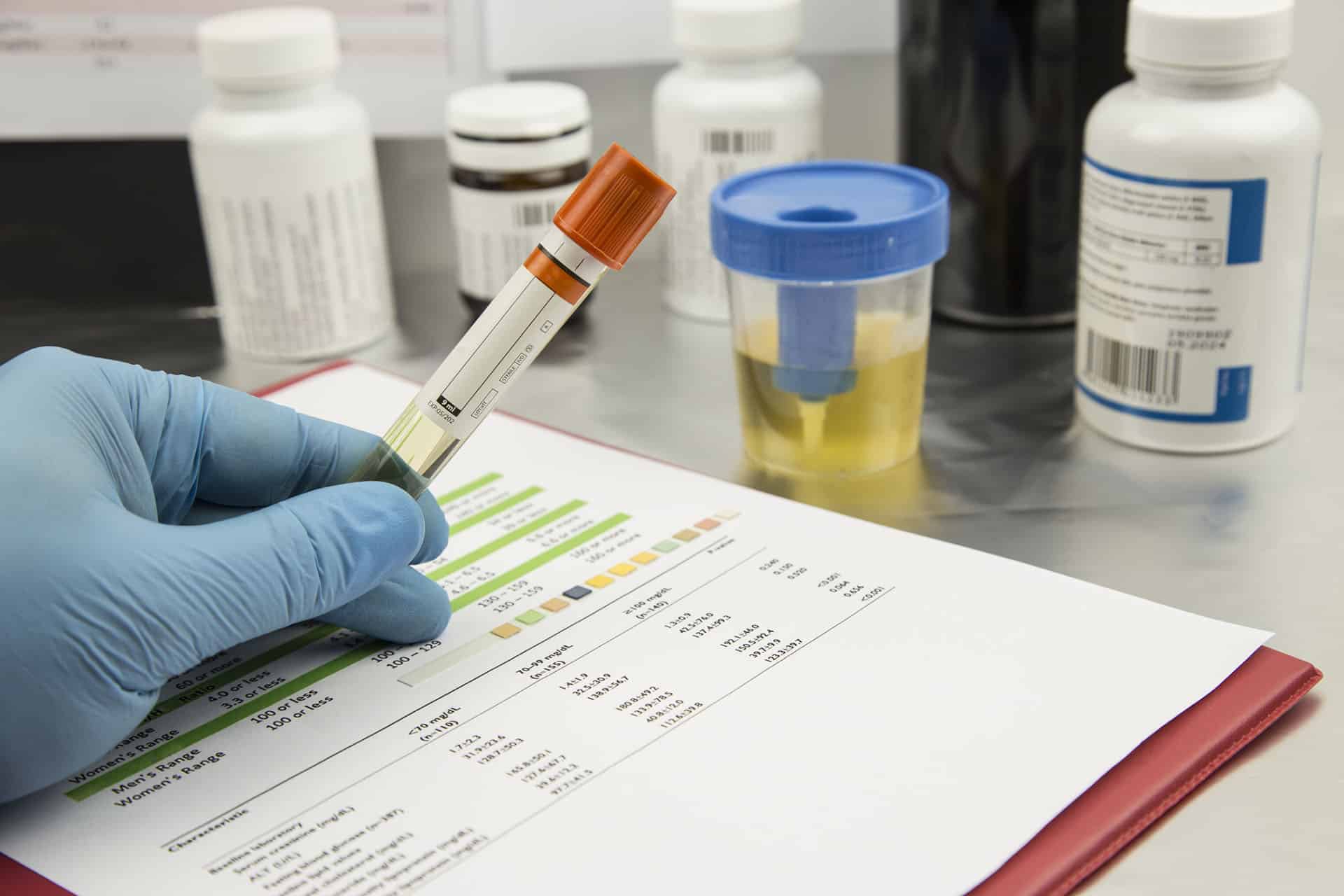 New Drug Testing Law Pennsylvania NJ Maryland Calif 